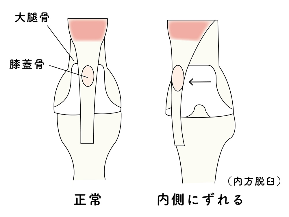 滑るダックス